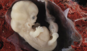 Senate Faces Push to Ban Abortion Pill