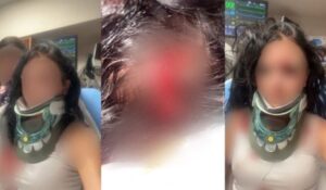 3 Women Yelled “Free Karmelo!” During Brutal Beating of White Woman, Victim Says