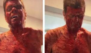 Perez Hilton Taken by Ambulance After Disturbing TikTok Livestream