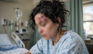 Seattle Woman Charged After Allegedly Biting a Chunk From Another…